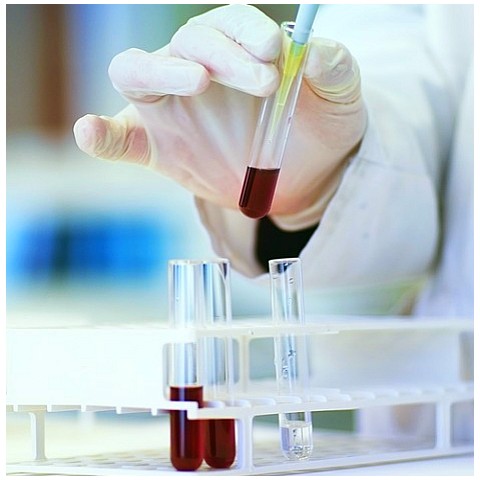 Анализ крови на общий белок