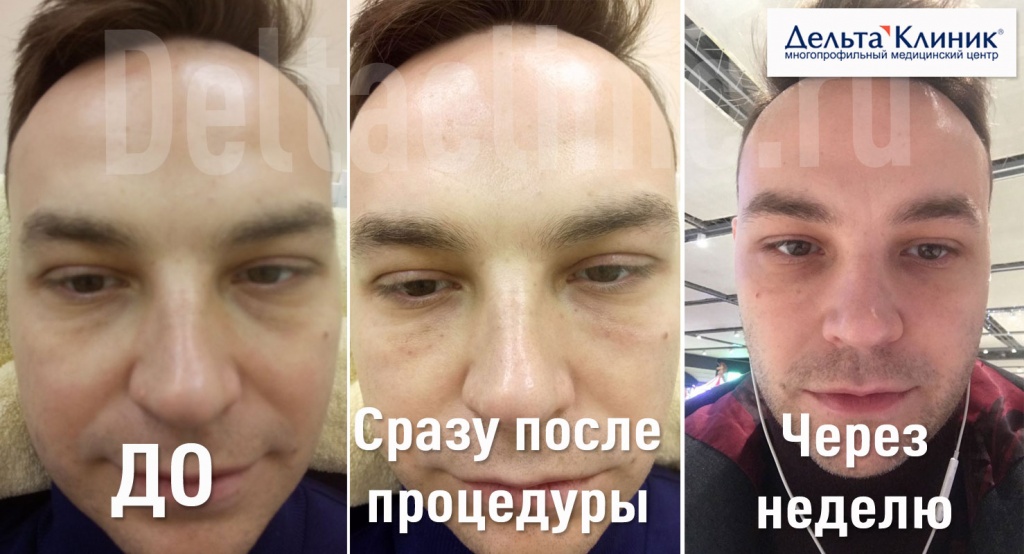 inektsionnaya_kosmetologiya