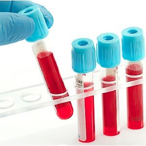 Анализ крови на белковые фракции
